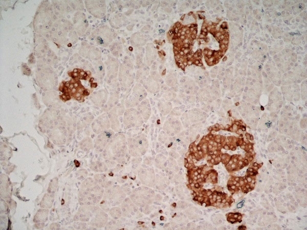 Anti Human Glutamate Decarboxylase 2 (N-Terminal) Antibody, clone N-GAD65 gallery image 2