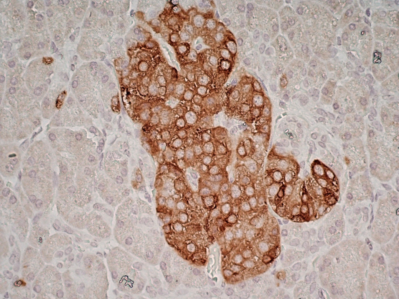 anti-human-glutamate-decarboxylase-2-n-terminal-antibody-clone-n