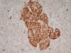 Anti Human Glutamate Decarboxylase 2 (N-Terminal) Antibody, clone N-GAD65 gallery image 4