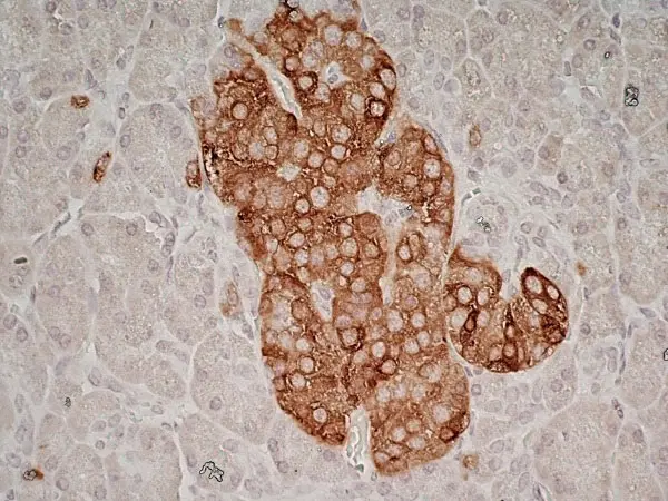 Anti Human Glutamate Decarboxylase 2 (N-Terminal) Antibody, clone N-GAD65 gallery image 4