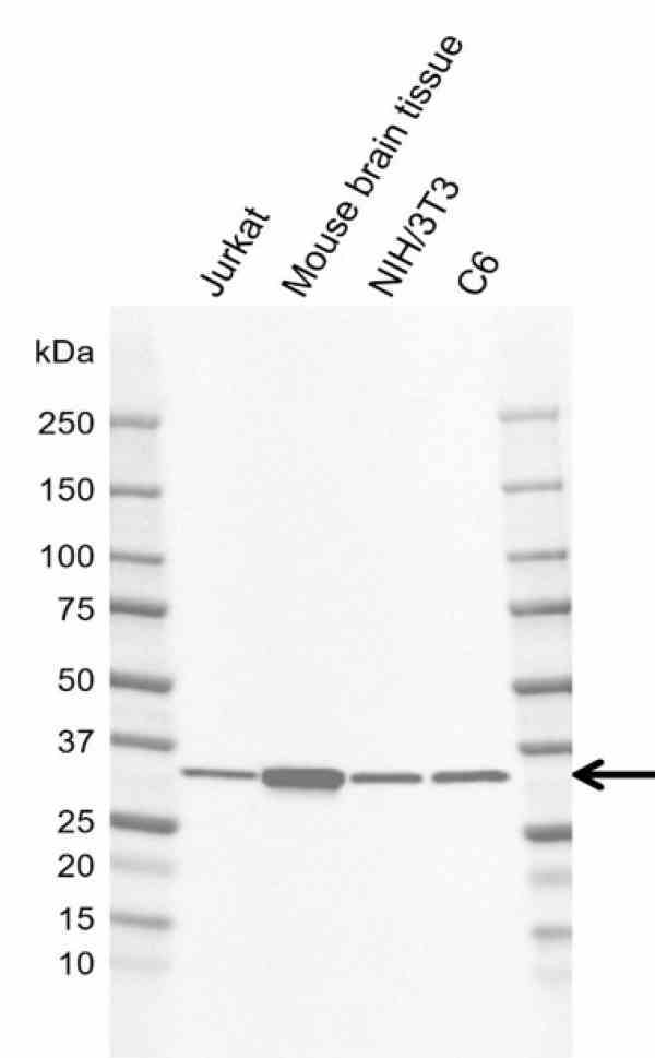 Anti Human GNB1 Antibody, clone AB04/2E5 (Monoclonal Antibody Antibody) gallery image 1