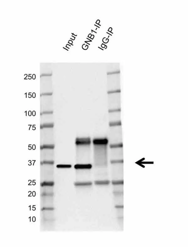 Anti Human GNB1 Antibody, clone AB04/2E5 (Monoclonal Antibody Antibody) gallery image 2