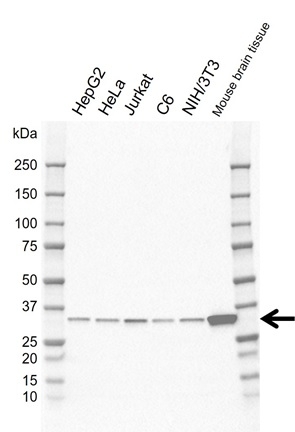 Anti GNB3 Antibody, clone EF01/1A12 (PrecisionAb Monoclonal Antibody) gallery image 1
