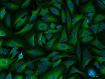 Anti GPI Antibody, clone CPTC31 (PrecisionAb Monoclonal Antibody) gallery image 2