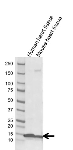Anti H-FABP Antibody (PrecisionAb Monoclonal Antibody) gallery image 1