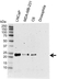 Anti Human H-Ras Antibody, clone H-Ras-03 (Monoclonal Antibody Antibody) thumbnail image 2
