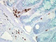 Anti Heat Shock Protein 70 Antibody, clone C92F3A-5 gallery image 2