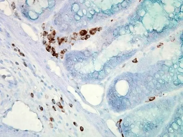 Anti Heat Shock Protein 70 Antibody, clone C92F3A-5 gallery image 2