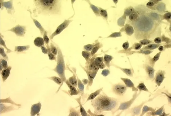 Anti Heat Shock Protein 70 Antibody, clone C92F3A-5 gallery image 3