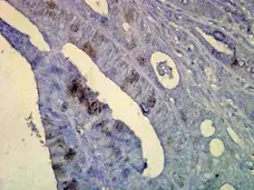 Anti Heat Shock Protein 70 Antibody, clone C92F3A-5 gallery image 4