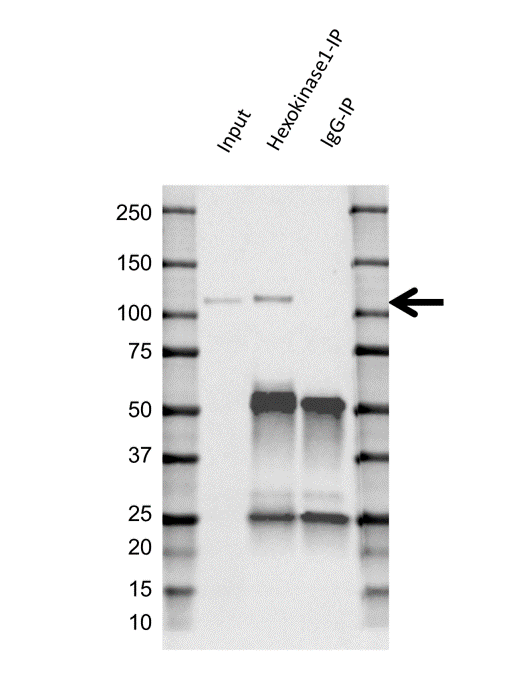 Anti Hexokinase 1 Antibody, clone 7A7 (PrecisionAb Monoclonal Antibody) gallery image 4