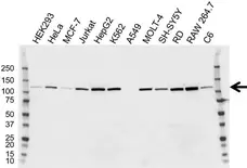 Anti Hexokinase 2 Antibody, clone OTI4C5 (PrecisionAb Monoclonal Antibody) gallery image 1