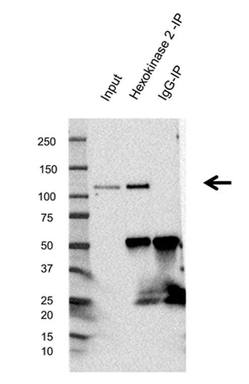 Anti Hexokinase 2 Antibody, clone OTI4C5 (PrecisionAb Monoclonal Antibody) gallery image 4