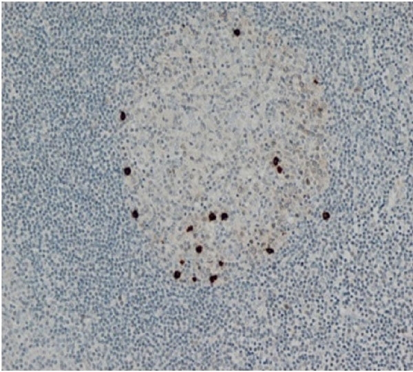 Anti Human HIF1 Alpha Antibody, clone Halpha111a gallery image 1