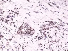 Anti HIF1 Alpha Antibody, clone RM242 gallery image 2