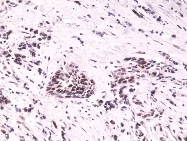 Anti HIF1 Alpha Antibody, clone RM242 gallery image 2