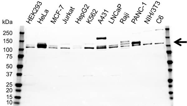 Anti HIF2 Alpha Antibody (PrecisionAb Monoclonal Antibody) gallery image 1