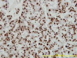 Anti Human High Mobility Group Protein B1 Antibody, clone 1D5 gallery image 2