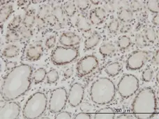 Anti Human High Mobility Group Protein B1 Antibody, clone 1E6-E10 gallery image 1