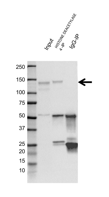 Anti Histone Deacetylase 4 Antibody, clone 7B2 (PrecisionAb Monoclonal Antibody) gallery image 2