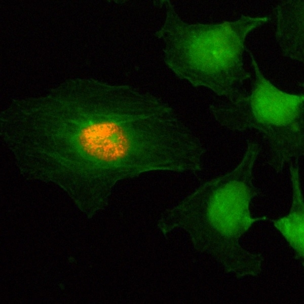 Anti Histone H2A/H4 (pSer1) Antibody, clone RM216 gallery image 2