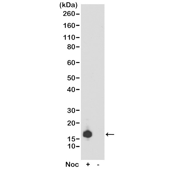 Anti Histone H3F3A (pSer10) Antibody, clone RM163 gallery image 1