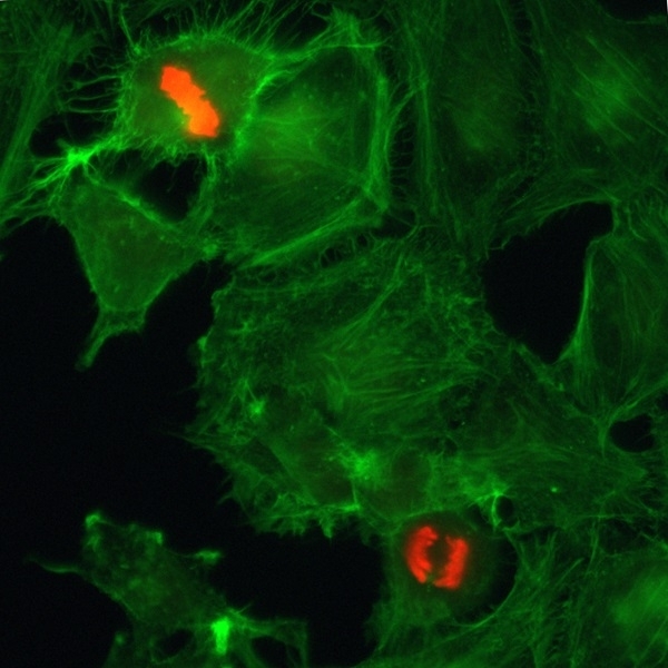 Anti Histone H3F3A (pSer10) Antibody, clone RM163 gallery image 2