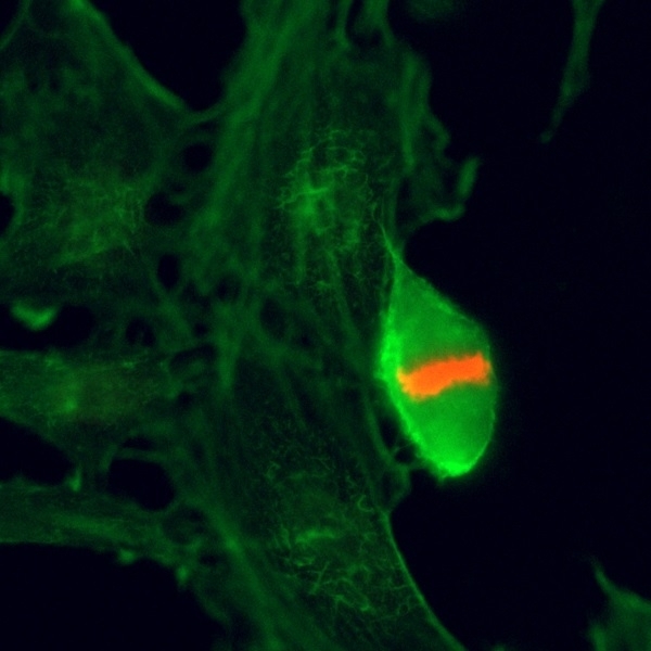 Anti Histone H3F3A (pThr3) Antibody, clone RM159 gallery image 2