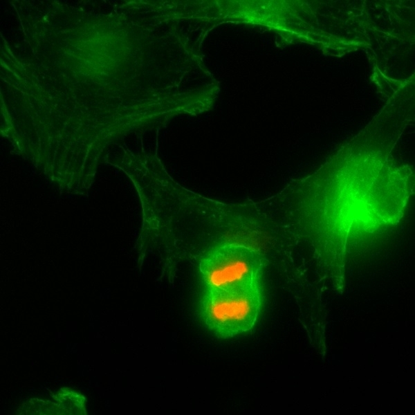 Anti Histone H3F3A (pThr3) Antibody, clone RM159 gallery image 3