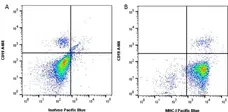 Anti Human HLA ABC Antibody, clone W6/32 gallery image 1
