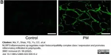 Anti Human HLA ABC Antibody, clone W6/32 gallery image 18