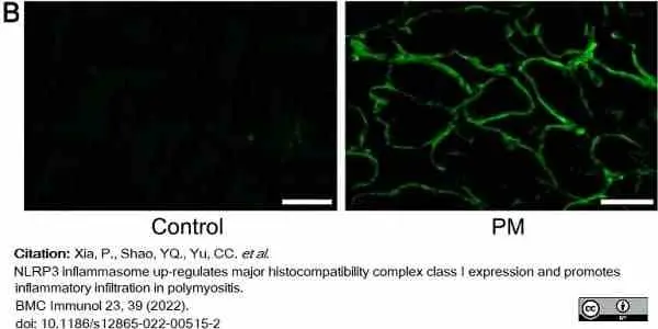 Anti Human HLA ABC Antibody, clone W6/32 gallery image 18