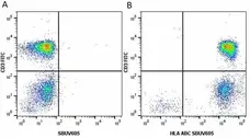 Anti Human HLA ABC Antibody, clone W6/32 gallery image 22