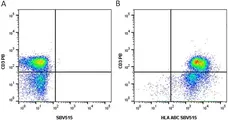 Anti Human HLA ABC Antibody, clone W6/32 gallery image 5