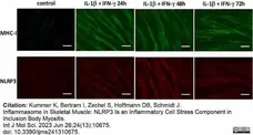 Anti Human HLA ABC Antibody, clone YTH862.2 gallery image 2