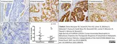 Anti Human HLA E Antibody, clone MEM-E/02 gallery image 2