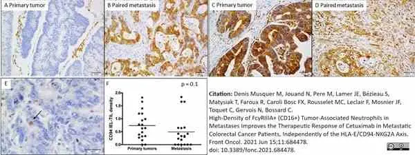 Anti Human HLA E Antibody, clone MEM-E/02 gallery image 2