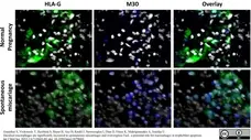 Anti Human HLA G Antibody, clone MEM-G/9 gallery image 3