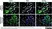 Anti Human HLA G Antibody, clone MEM-G/9 thumbnail image 3