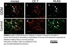 Anti Human HLA G Antibody, clone MEM-G/9 gallery image 5