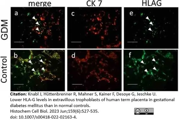 Anti Human HLA G Antibody, clone MEM-G/9 gallery image 5