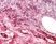 Anti Human iC3b (Neoantigen) Antibody, clone 013III-1.16 thumbnail image 1