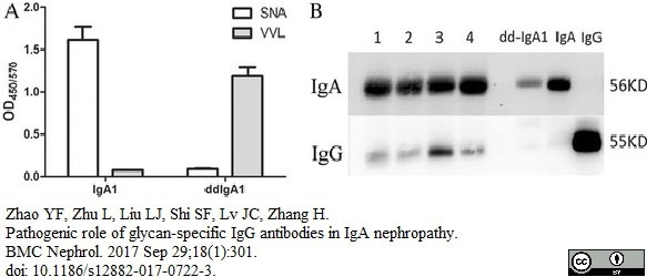 Anti Human IgA1 Alpha 1 Chain Antibody, clone B3506B4 gallery image 2