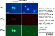 Anti Human IgM Antibody, clone M15/8 gallery image 1