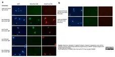 Anti Human IgM Antibody, clone M15/8 gallery image 2