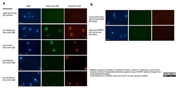 Anti Human IgM Antibody, clone M15/8 gallery image 2
