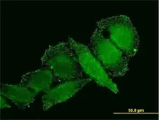 Anti Human IL-1 Beta Antibody, clone 2E8 gallery image 1
