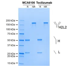 Anti IL6R (Tocilizumab Biosimilar) Antibody, clone rhPM-1 gallery image 1