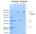 Anti IL6R (Tocilizumab Biosimilar) Antibody, clone rhPM-1 thumbnail image 1
