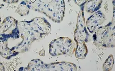 Anti Human Inhibin Alpha Antibody, clone R1 gallery image 10
